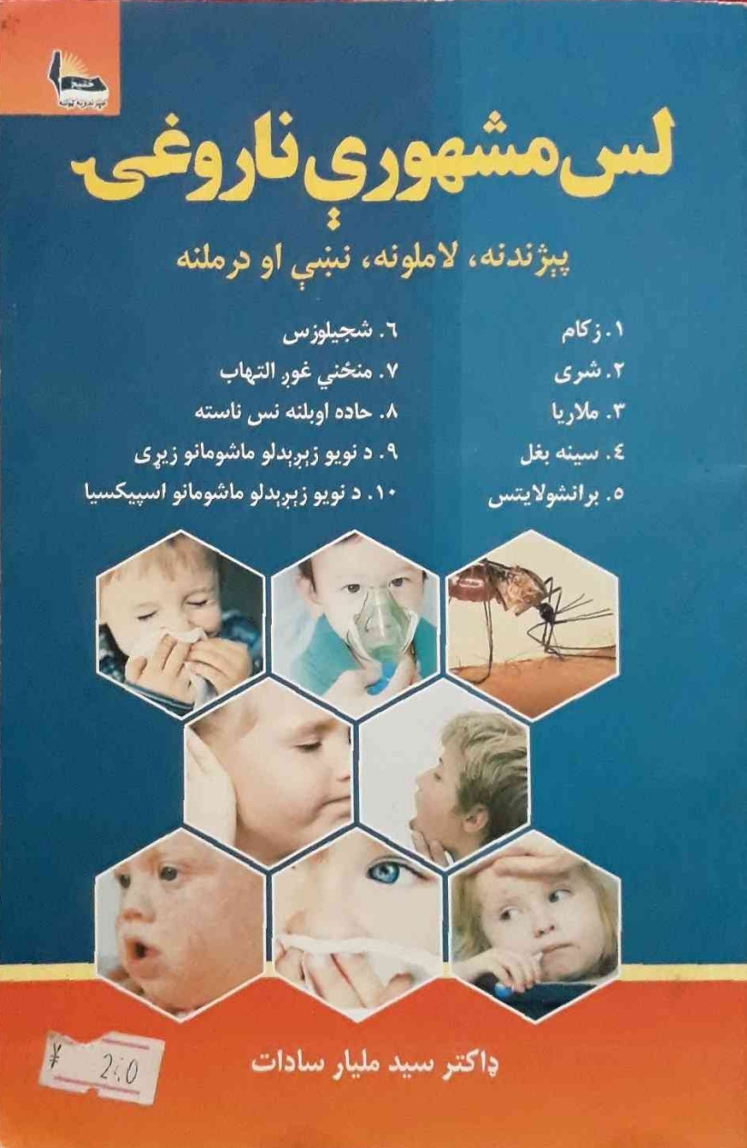 لس مشهورې ناروغۍ