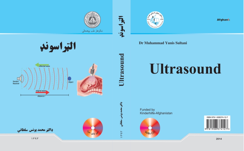 الټراساونډ